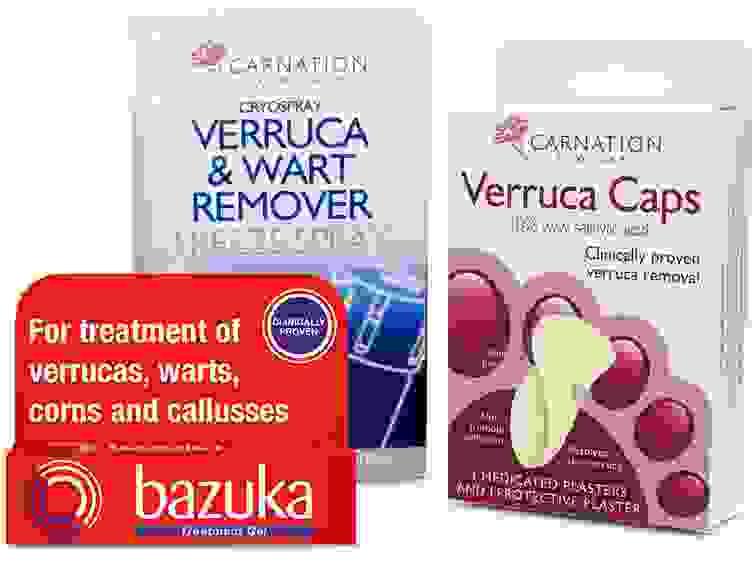 Verruca & Warts